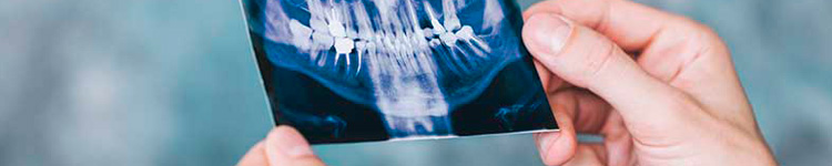 Рентген зубов в Измайлово